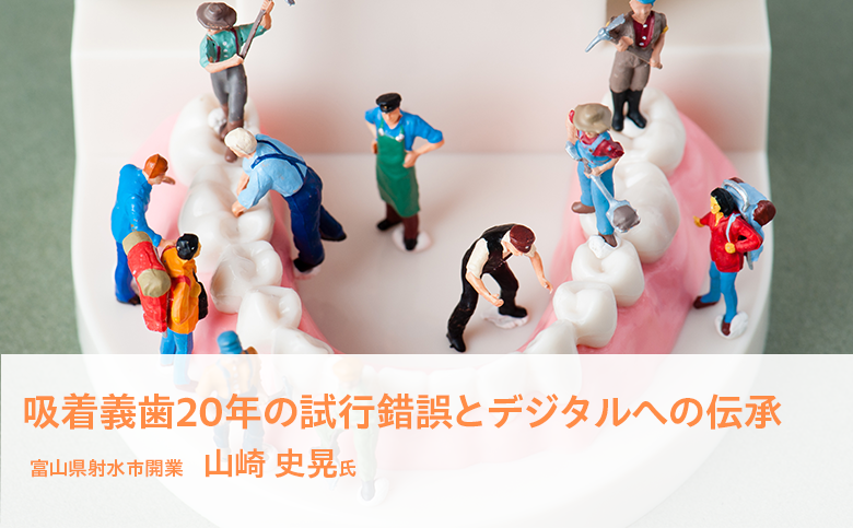 吸着義歯20年の試行錯誤とデジタルへの伝承